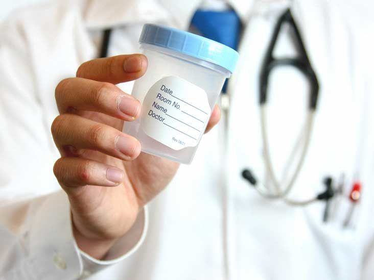 Naviguer dans l'effet d'entraînement : comprendre les causes de l'urine foncée 🌑 