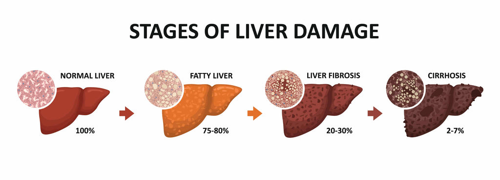 Safeguard Your Health: Understanding the Impact of Daily Alcohol Consumption on Your Liver 🍹🚫